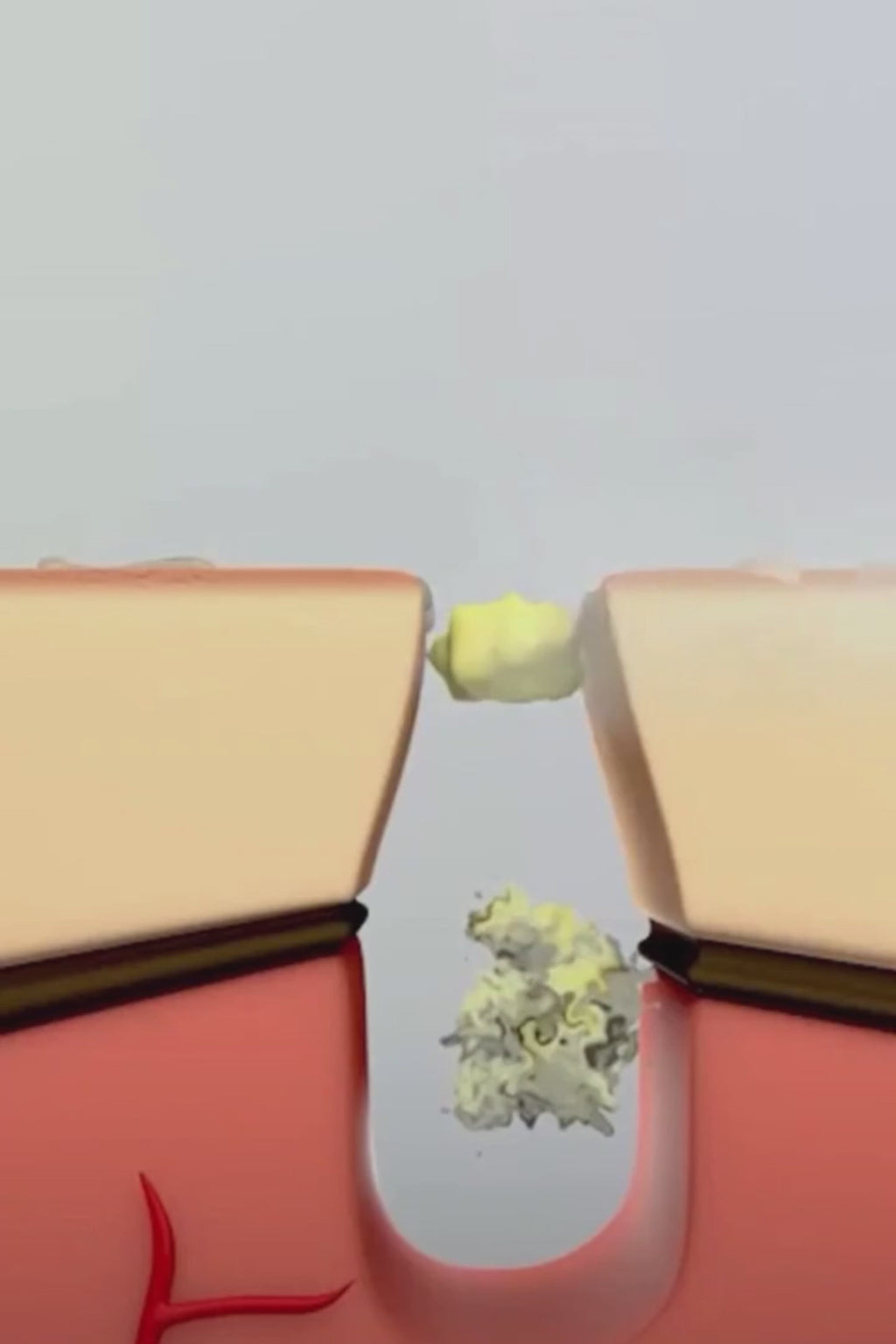 Spatule Peeling Ultrasonique – Nettoyage en Profondeur &amp; Éclat du Visage